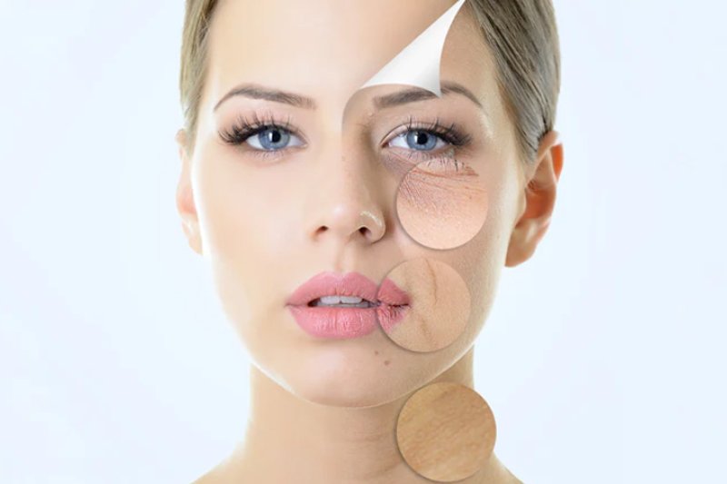 Result of Rejuvenation of Skin