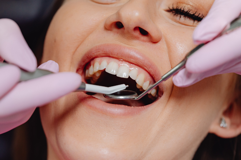 Dental Restoration / Fillings