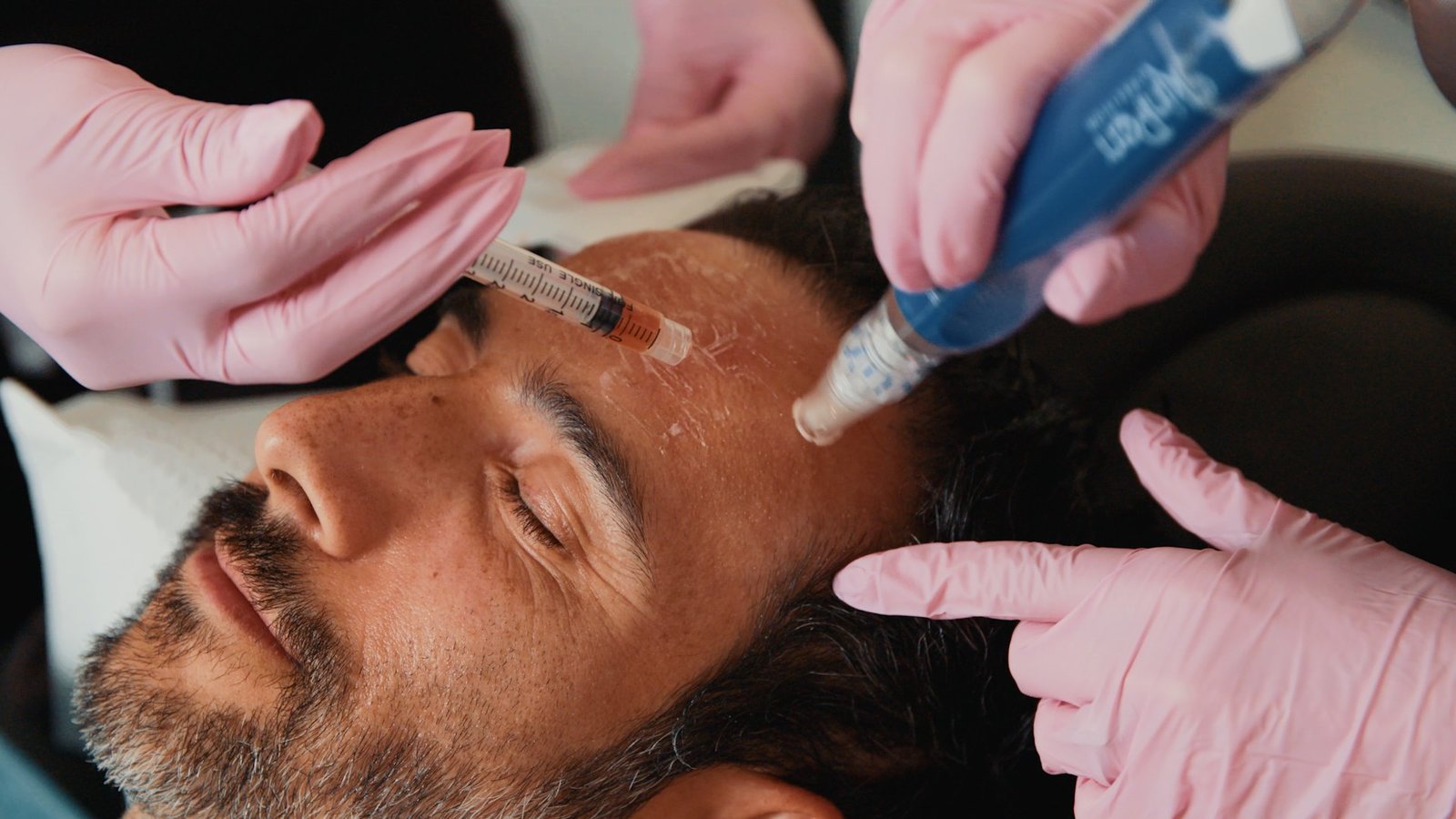 PRF Therapy